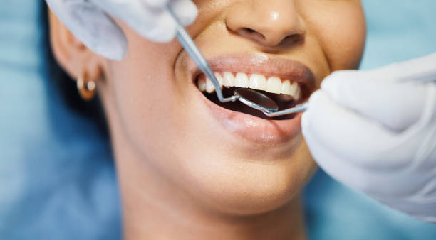 Best Emergency Dental Care for Abscessed Tooth in Star City, WV
