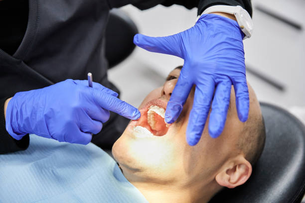 Best Emergency Dentist for Lost Fillings or Crowns in Star City, WV